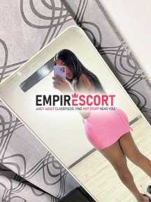🍓ven aki hay 🍓 carne fresca y de buena 🍓 kataleya 🍓 top a1 vip 🍓 fiestera🍓 🏨 habitaciÓn las 24 horas 🏨